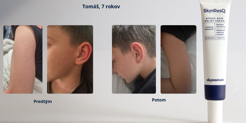 Tomáš, 7 rokov